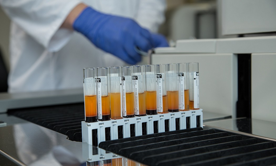 Reagenzgläser im Labor zur Blutgruppenbestimmung