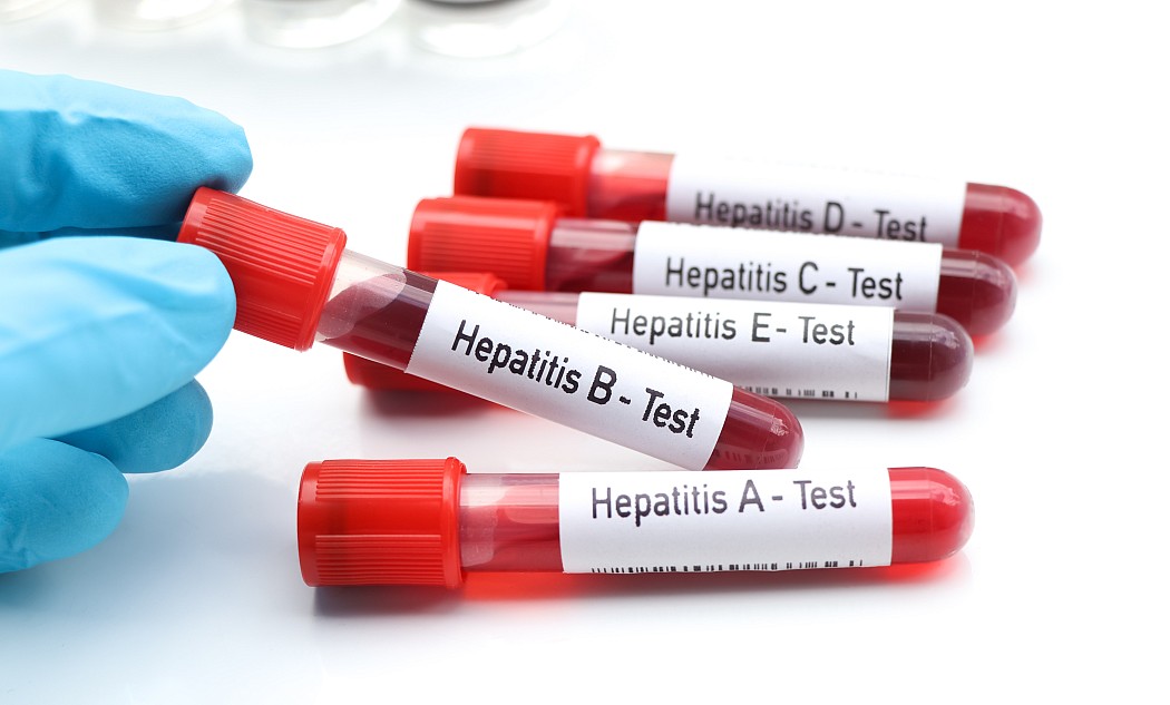 hepatitis-roehrchen-test-labor