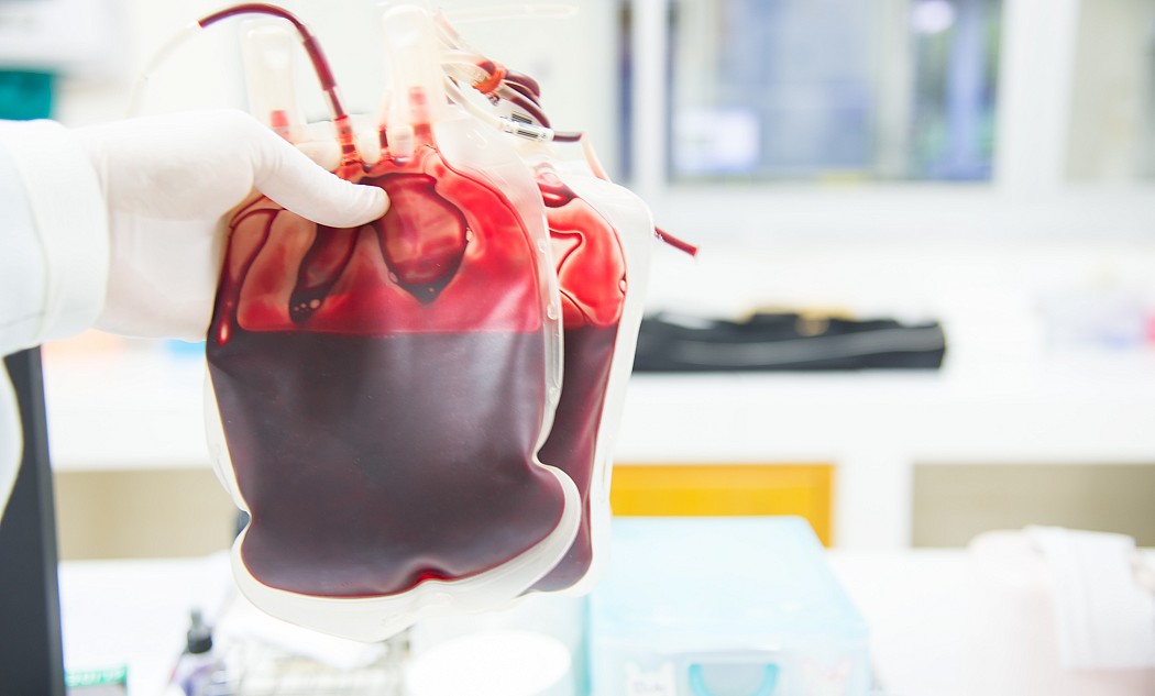 bluttransfusion-blutbeutel-transfusion