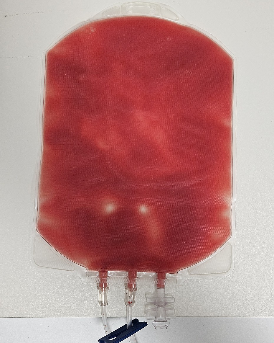 Depletierte Stammzellen